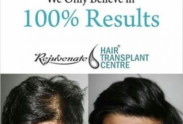 BEST HAIR TRANSPLANT FOR MEN AND WOMEN IN INDIA