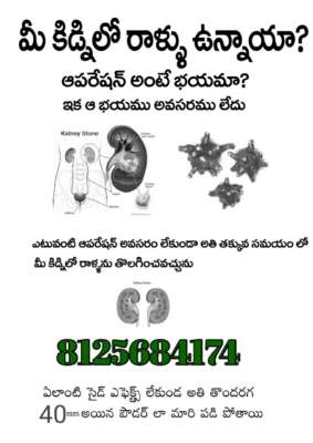 100 percnt cure for kidney stones without any operation .just with herbs ur prblm will b solved
