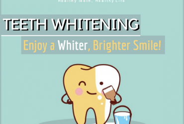 Brighten up your smile with our tooth whitening Treatments