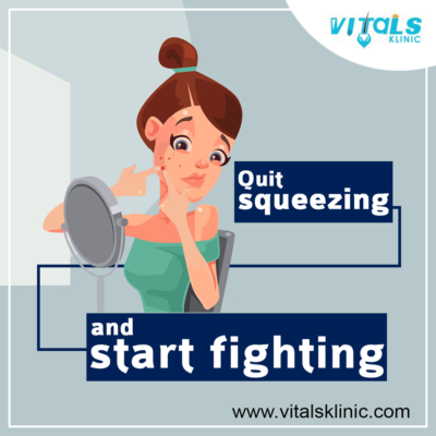Safe and Effective Mole Removal in Bangalore