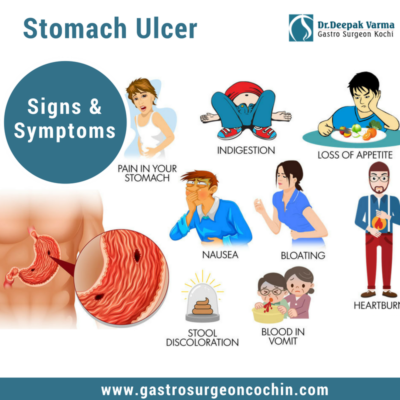 Get Effective Treatment for Ulcers