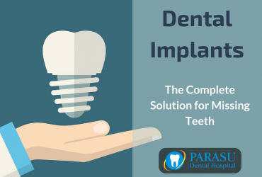 Replace Your Missing Teeth With Dental Implants