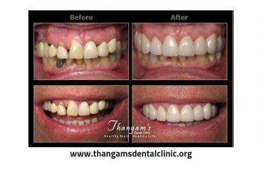 Restore your Smile with Cosmetic Dentistry