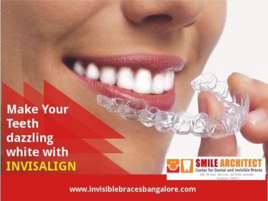 Straighten Your Teeth with Invisalign