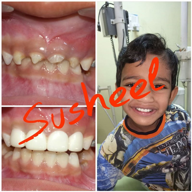 Best Dentist near me