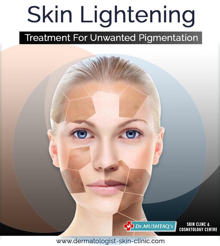 Get Brighter & Lighter Skin Safely With Dr Mushtaq Ali