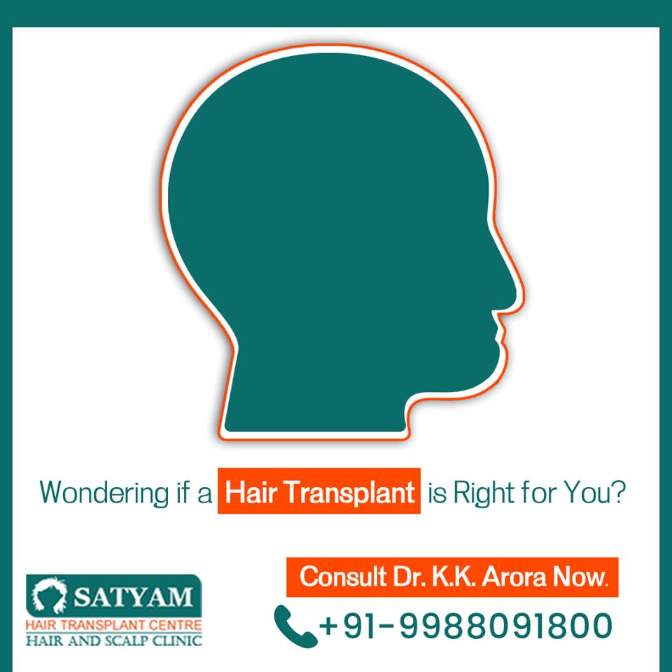 Best Hair Transplant in Punjab
