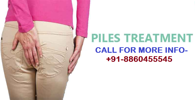 PH – 8860455545 – Piles treatment in New colony Deoria