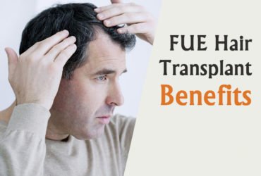 Best FUE Hair Transplant in Hyderabad | Hitech City | Madhapur