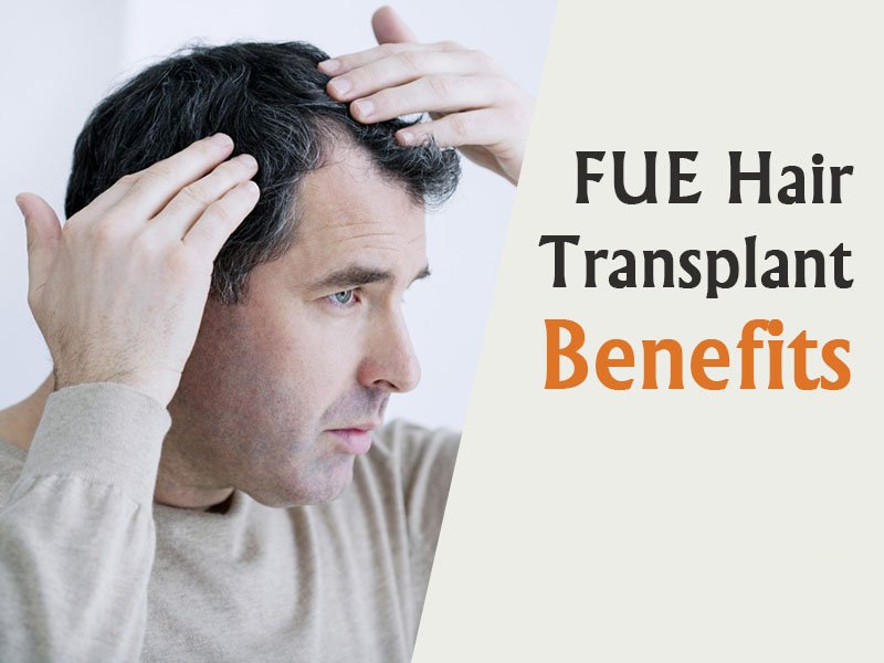 Best FUE Hair Transplant in Hyderabad | Hitech City | Madhapur