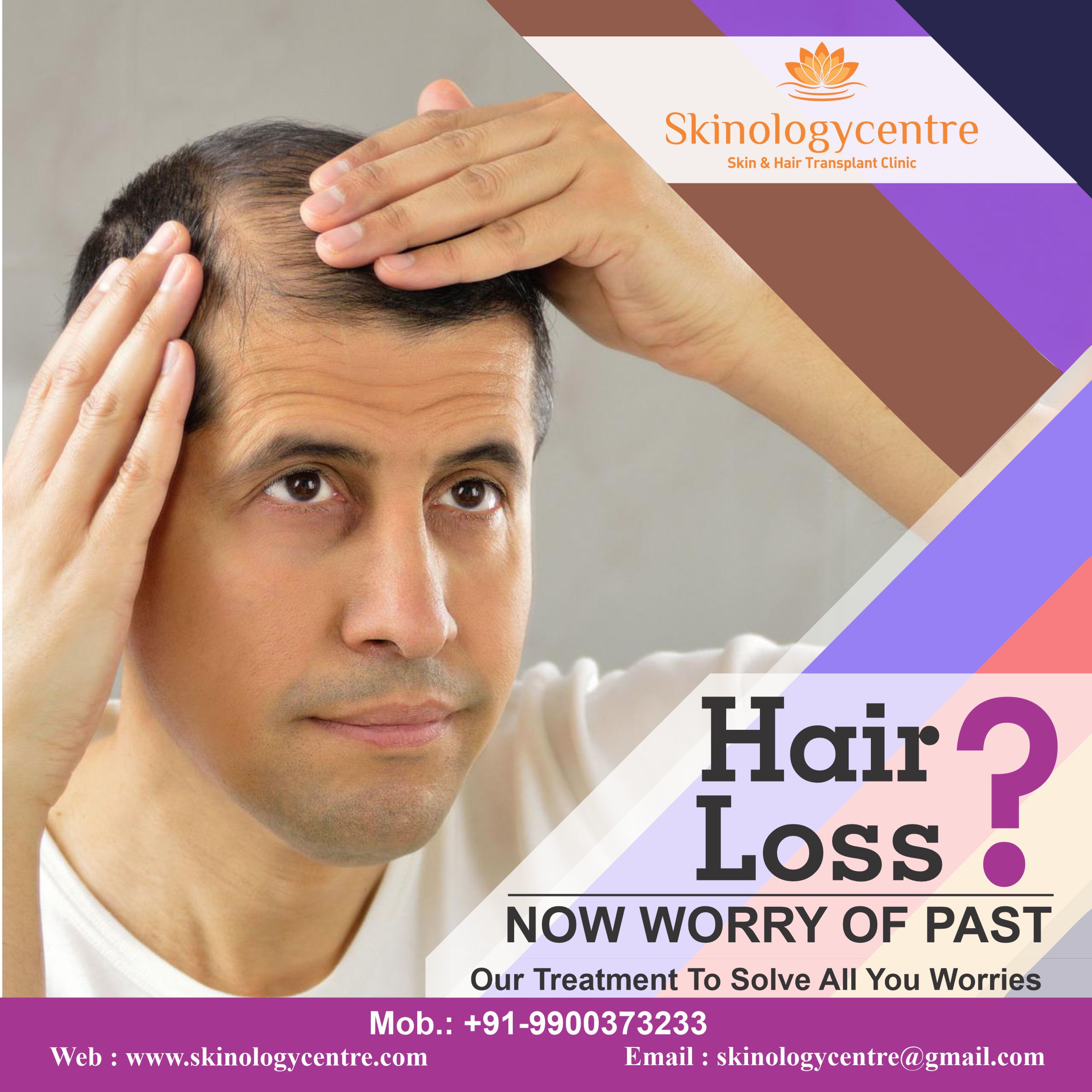 Hair Transplant Cost in Bangalore | FUE Hair Transplant @ Rs.29,999/