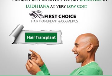 Best hair Transplant Clinic in Amritsar | First Choice Hair Transplant & Cosmetics
