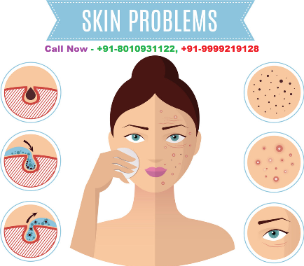 8010931122 :: Skin Specialist doctor in Uttam Nagar West