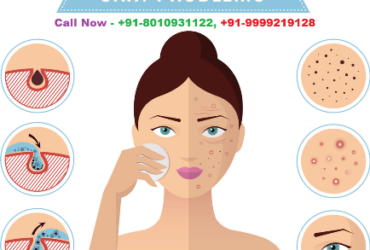 Lady Skin Specialist doctor in Uttam Nagar West :: 8010931122