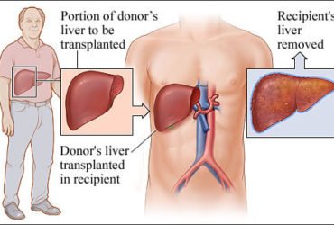 Aarogya Hospital – Liver Specialist in Ghaziabad