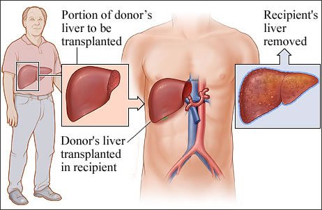 Aarogya Hospital – Liver Specialist in Ghaziabad