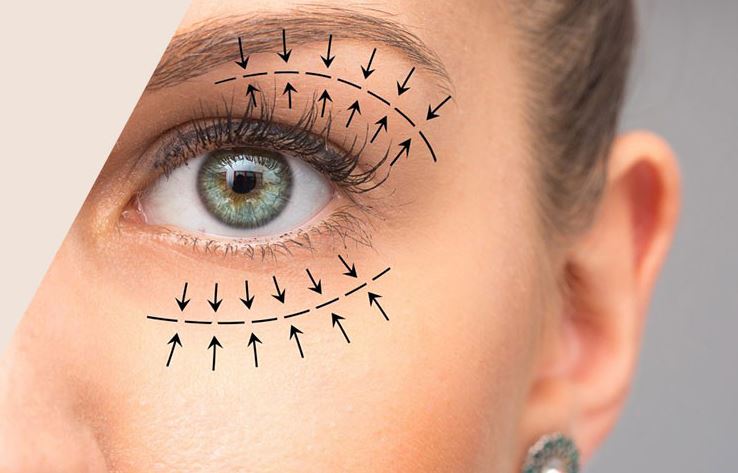 Private: Blepharoplasty surgeon in Mumbai