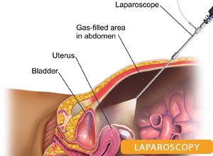 Best Urologist in Patna Bihar: Dr. Kumar Rajesh Ranjan
