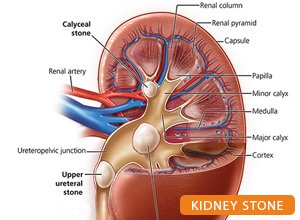Best Nephrologist in Patna Bihar: Dr. Kumar Rajesh Ranjan