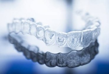 Aligners in Orthodontics-Eazyalign