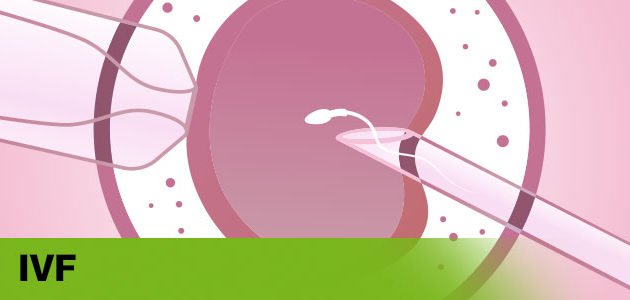 Best IVF Center in pune – ONP Hospitals