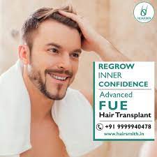 Best hair transplant treatment in delhi