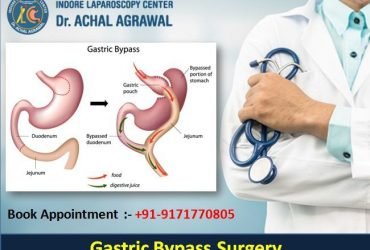 Dr. Achal Agrawal Specialist at Indore Laparoscopy Center