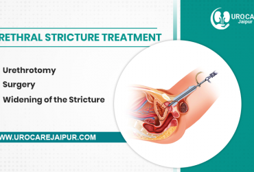 Get UTI treatment by Dr. Lokesh Sharma – Best Urologist in jaipur