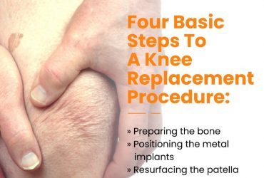 Are you looking for Best Knee Specialist In Hyderabad