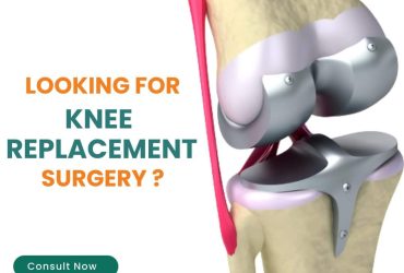 Best knee replacement surgeon in Lucknow | HLC Hospital