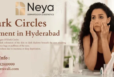 Dark circles Treatment in Hyderabad