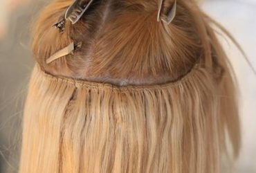 Best Hair Patch Service in Rohini