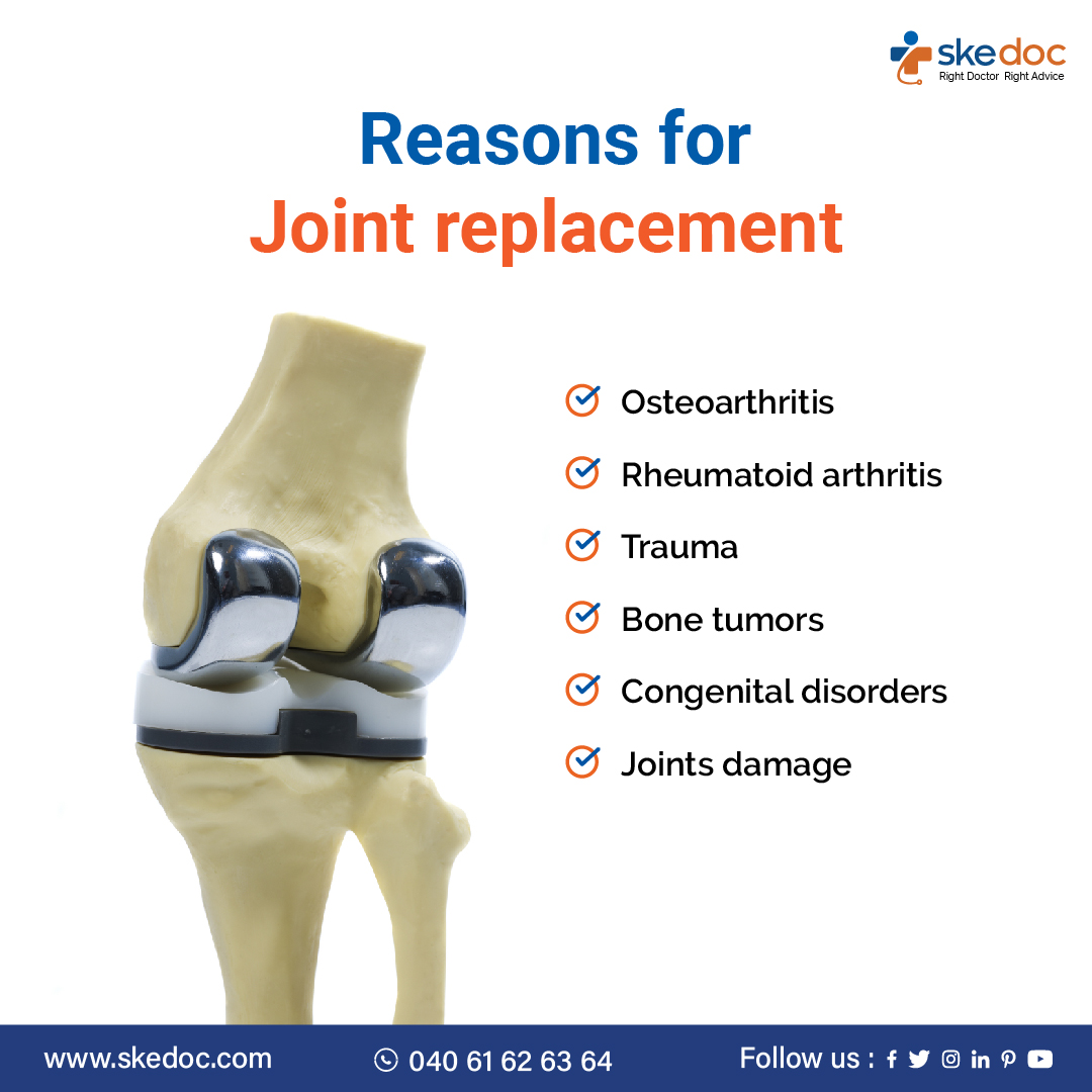 Best Joint Replacement Surgeons in Hyderabad | skedoc
