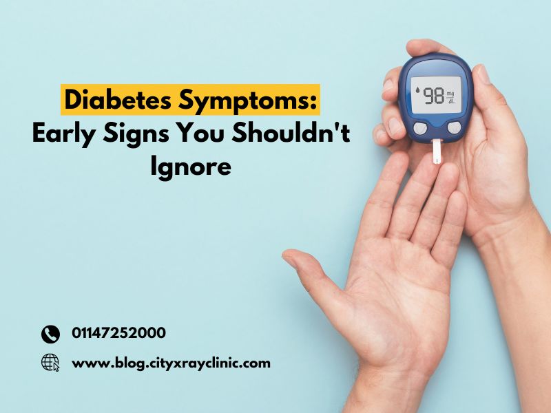 Diabetes Symptoms: Early Signs You Shouldn't Ignore