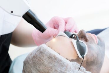 Pico laser Treatment In Dwarka