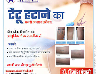 Public: Easiest and Safest Way to Remove Tattoos!