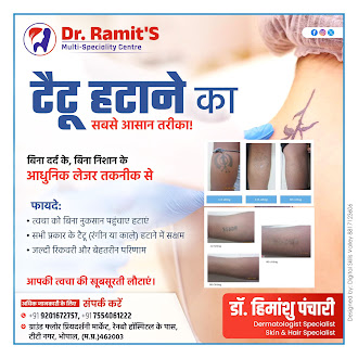 Public: Easiest and Safest Way to Remove Tattoos!